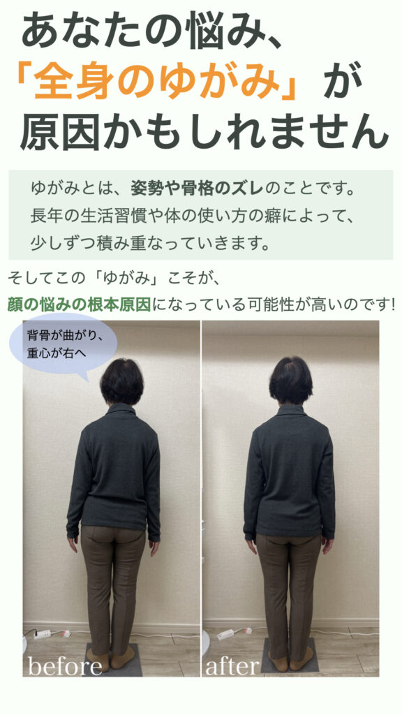 あなたの悩み、『全身のゆがみ』が原因かもしれません
ゆがみとは、姿勢や骨格のズレのことです。長年の生活習慣や体の使い方の癖によって、少しずつ積み重なっていきます。
そしてこの『ゆがみ』こそが、顔の悩みの根本原因になっている可能性が高いのです！