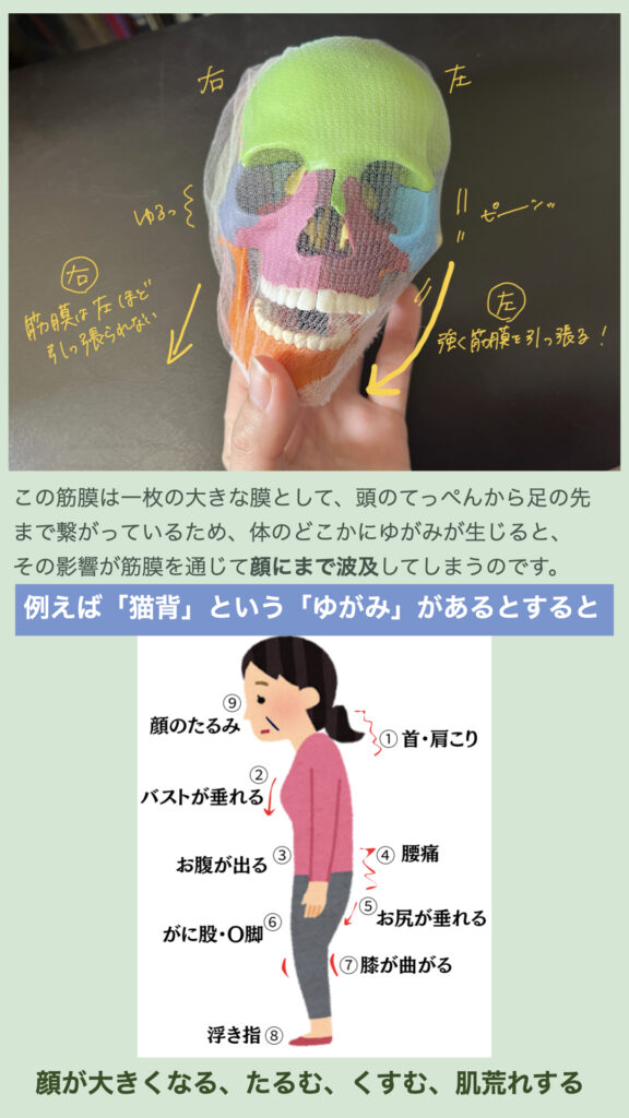この筋膜は一枚の大きな膜として、頭のてっぺんから足の先まで繋がっているため、体のどこかにゆがみが生じると、その影響が筋膜を通じて顔にまで波及してしまうのです！
例えば猫背だけでも、顔がおおきくなる、たるむ！